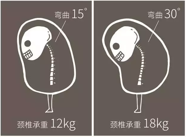 现代人是如何搞垮自己的脊椎的？